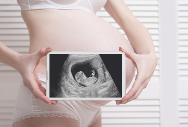 Les résultats de l'enquête échographique pour la femme enceinte sont sur  l'écran de l'appareil d'échographie, la femme au premier plan Photo Stock -  Alamy